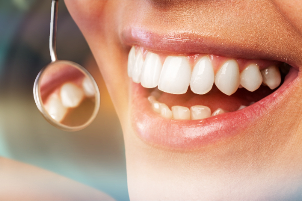 When Would A Dentist Recommend A Deep Teeth Cleaning?