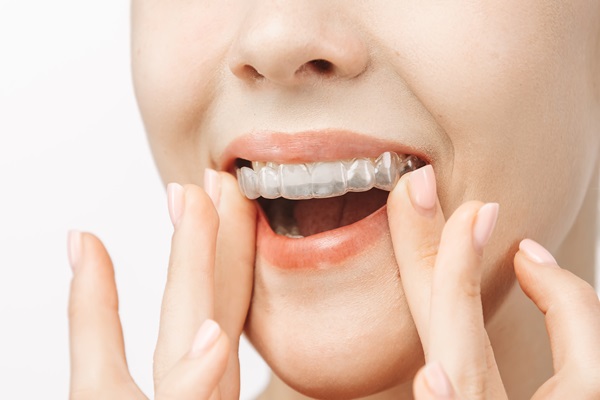 Clear Aligner Teeth Straightening Therapy From A Family Dentist