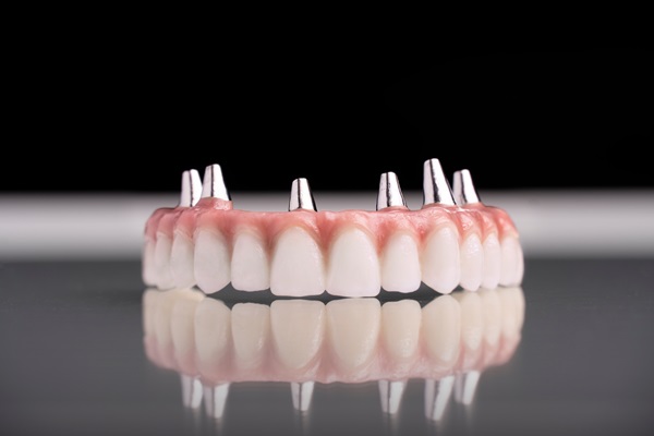 Get A New Smile With Implant Supported Dentures